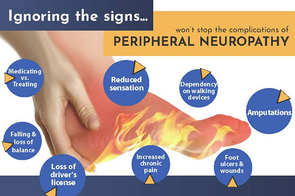 neuropaty