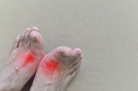 How to Manage Painful Gout