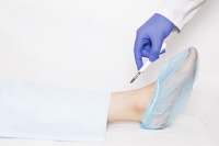 Stepping Forward With Confidence After Total Ankle Replacement